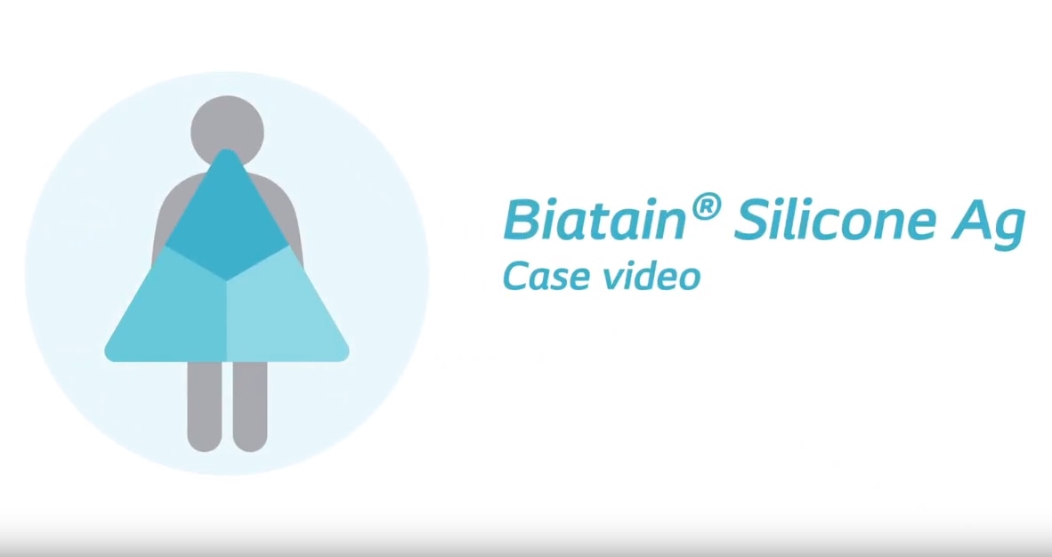 Biatain® Silicone Ag pasientstudie video