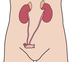 Urostomi Urostomi