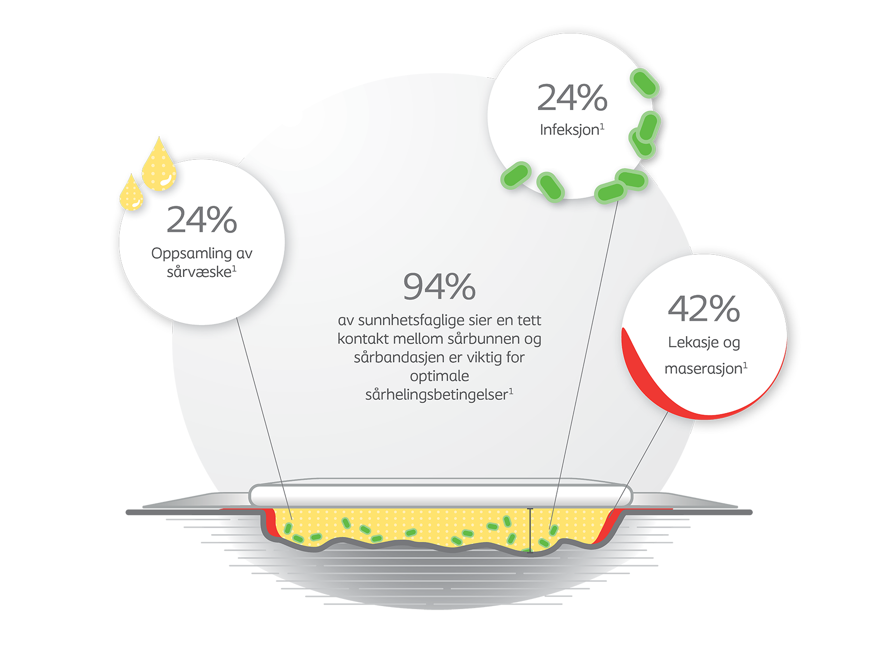 Nesten 80 % av sårene er mindre enn 2 cm dype <sup>2<sup>