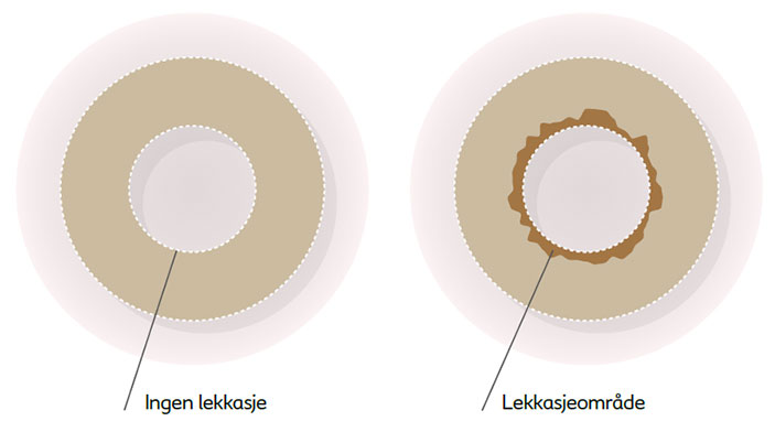 Tetningsring lekkasje