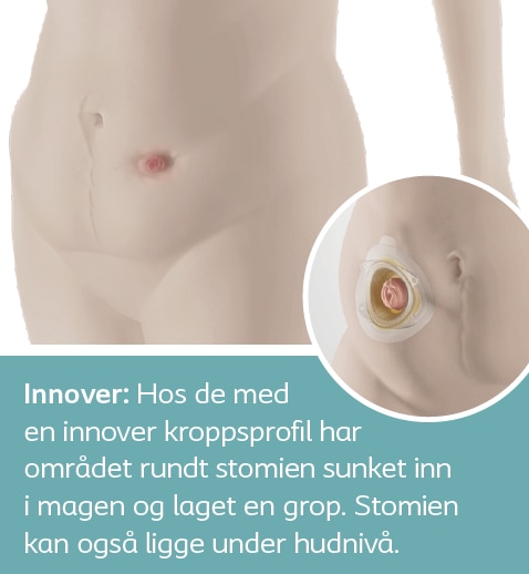 Innover kroppsprofil