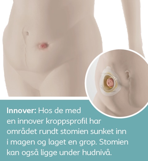 Innover kroppsprofil