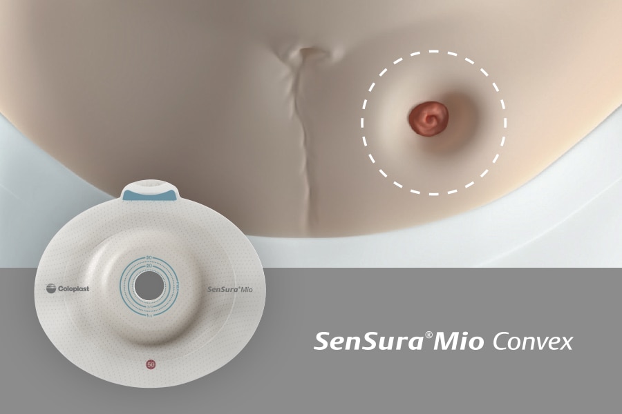SenSura Mio Convex for områder rundt stomien som går innover
